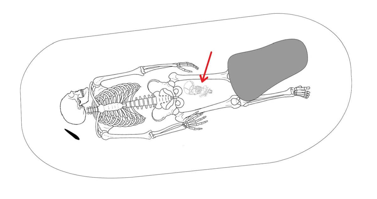 Interpretative drawing of a grave from Fjälkinge, Sweden, of an adult woman buried together with newborn placed between her thighs. Note that the legs of the woman’s body have been weighed down by a boulder. Matt Hitchcock / Body-Politics, CC BY-SA