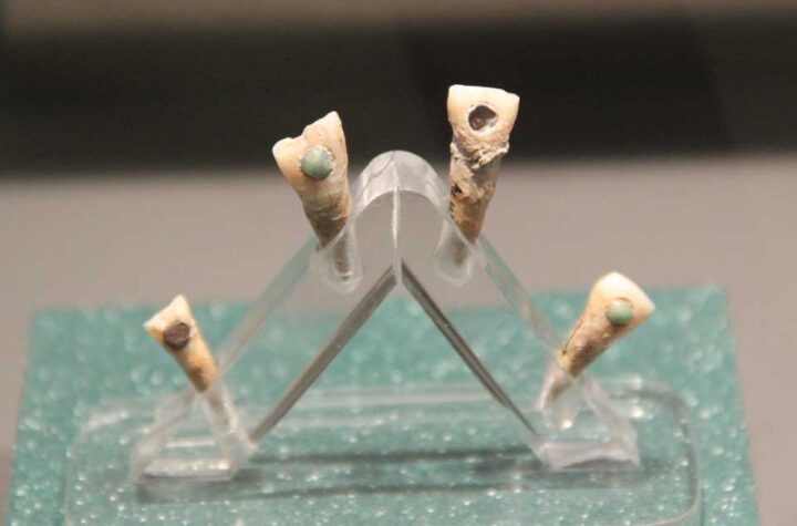 Featured image: Examples of dental inlays found in the teeth of ancient Maya individuals. These are not the teeth examined in the new study. (CC0)