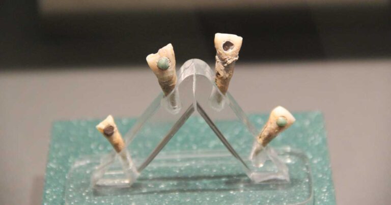 Featured image: Examples of dental inlays found in the teeth of ancient Maya individuals. These are not the teeth examined in the new study. (CC0)