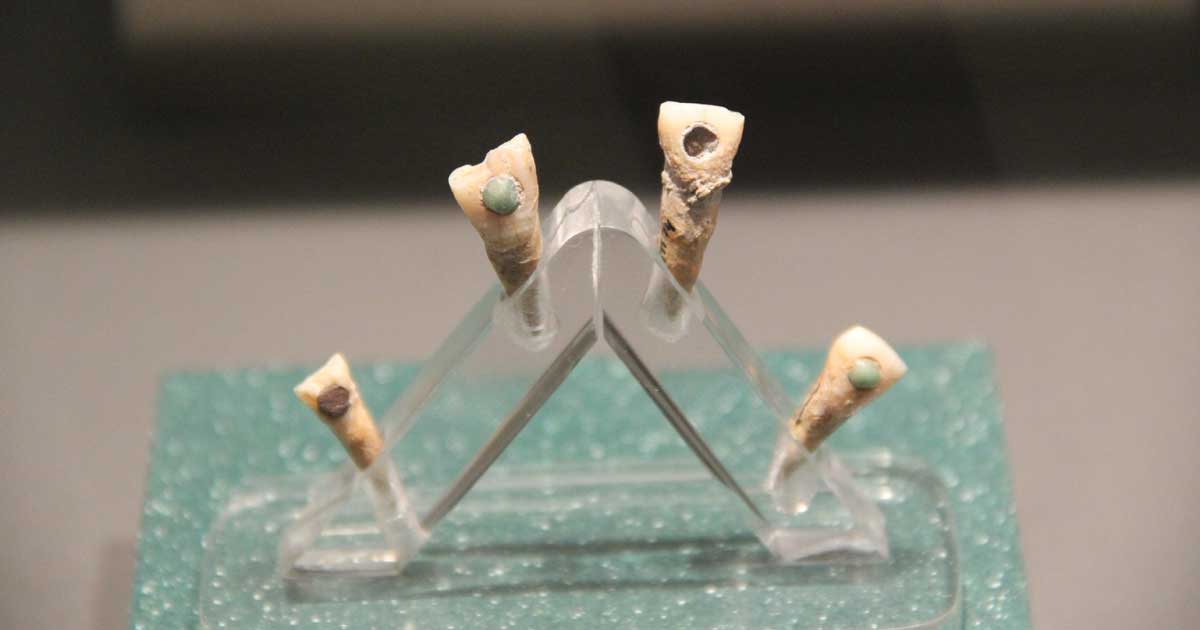7-Year-Old Maya Child Wore Jade “Tooth Gem” in Ancient Ritual Practice